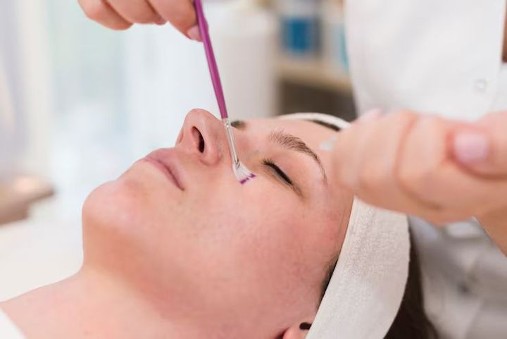 Non-Surgical Enlarged Pore Treatment Guide for Healthy and Clear Looking Skin